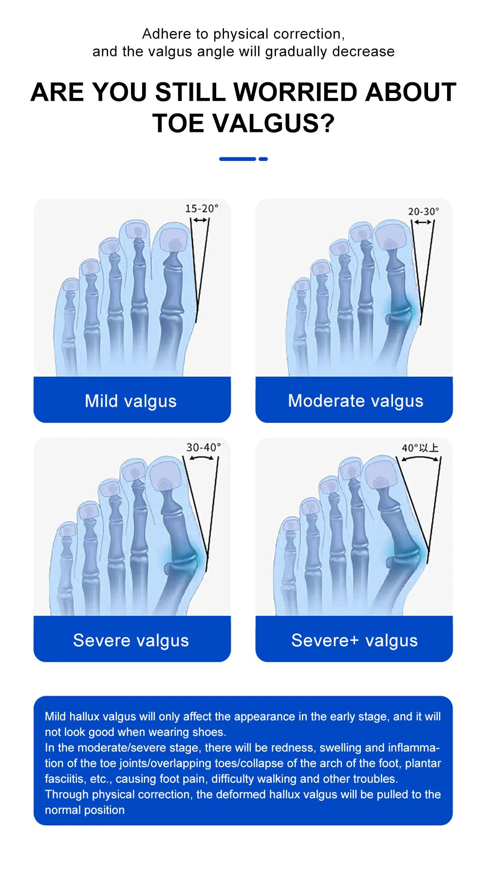 Big Bone Toe Bunion Straightener