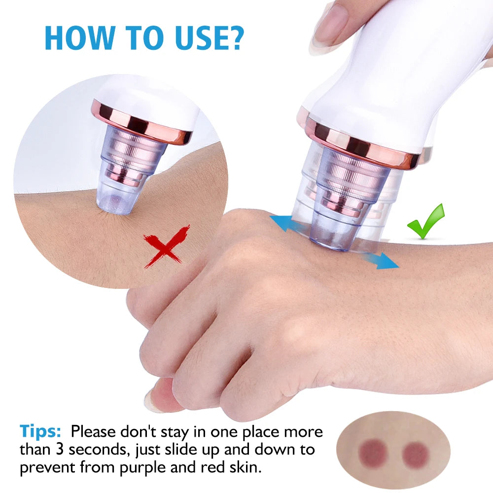 Electric Vacuum Blackhead Removal